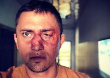 «Нанес ответный удар, и конфликт был исчерпан». Чем закончился суд над обидчиком Прилучного