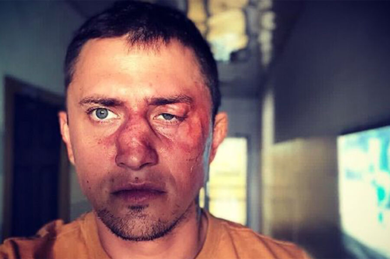 &laquo;Нанес ответный удар, и конфликт был исчерпан&raquo;. Чем закончился суд над&nbsp;обидчиком Прилучного 