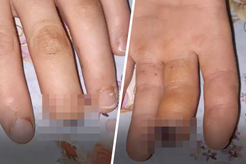 &laquo;Привезли ребенка и отдельно пальчик в&nbsp;пакетике&raquo;. Что произошло в&nbsp;школе под&nbsp;Иркутском 